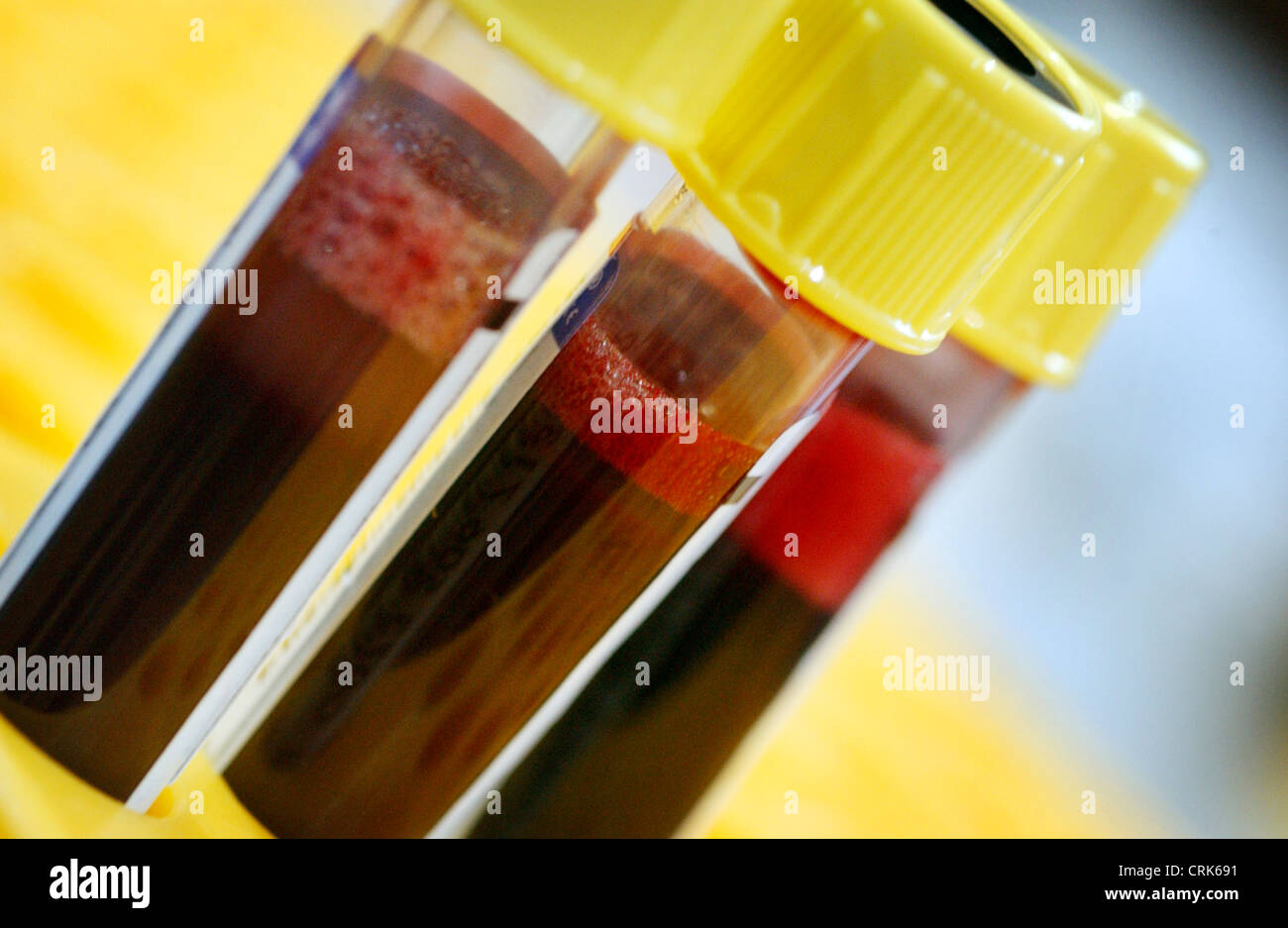 Campioni di sangue donato in Vacutainer provette con cime di giallo. Foto Stock