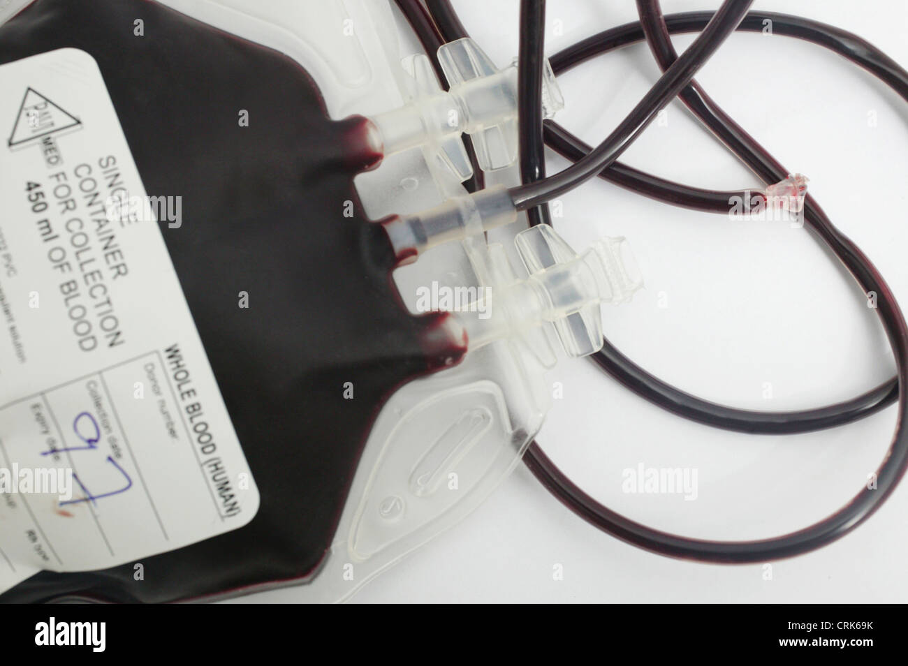 Non tipizzato sacca di sangue. Foto Stock