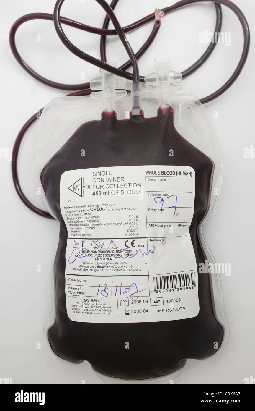 Non tipizzato sacca di sangue. Foto Stock