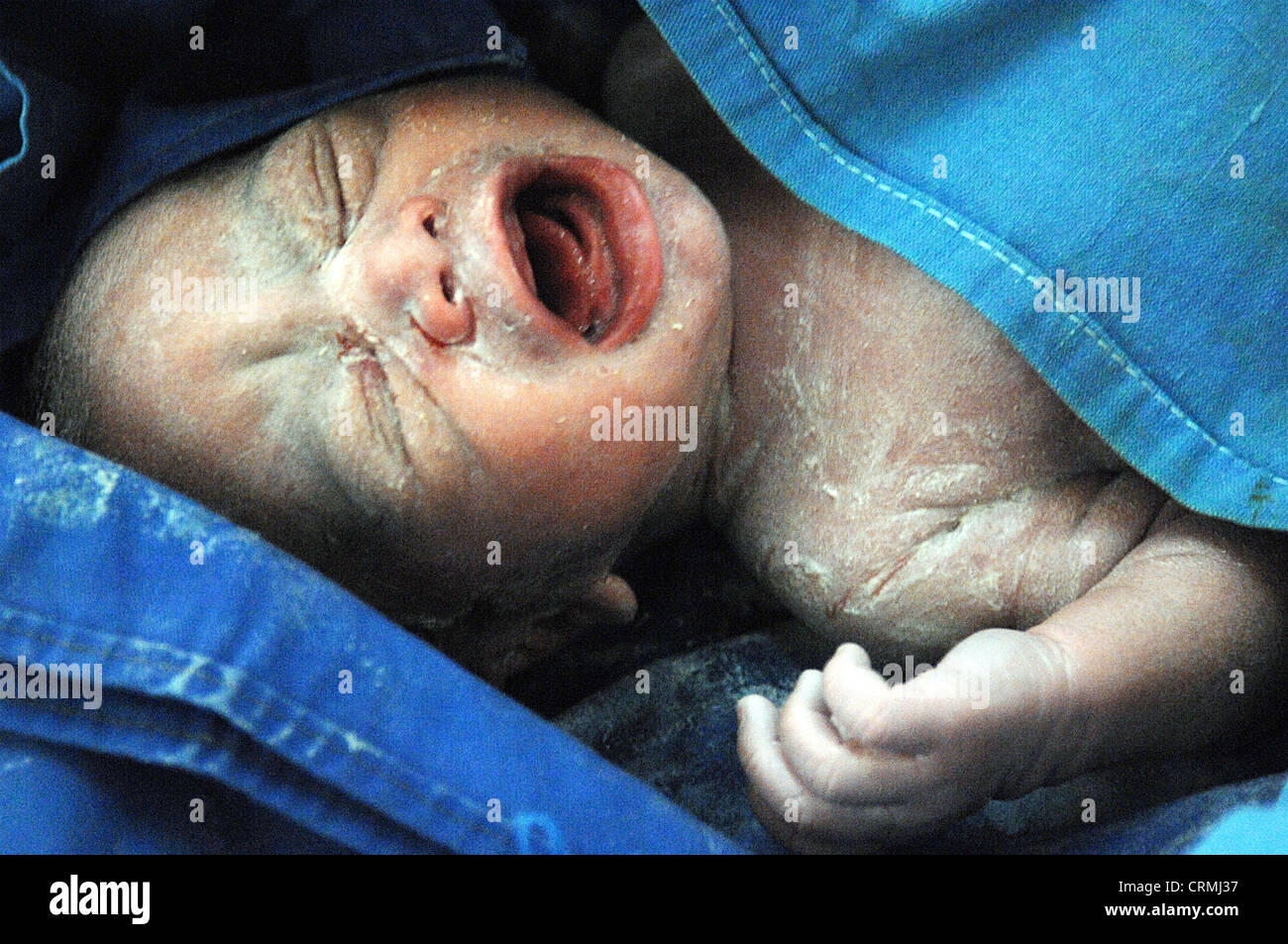 In prossimità della faccia di un neonato subito dopo la nascita. Foto Stock