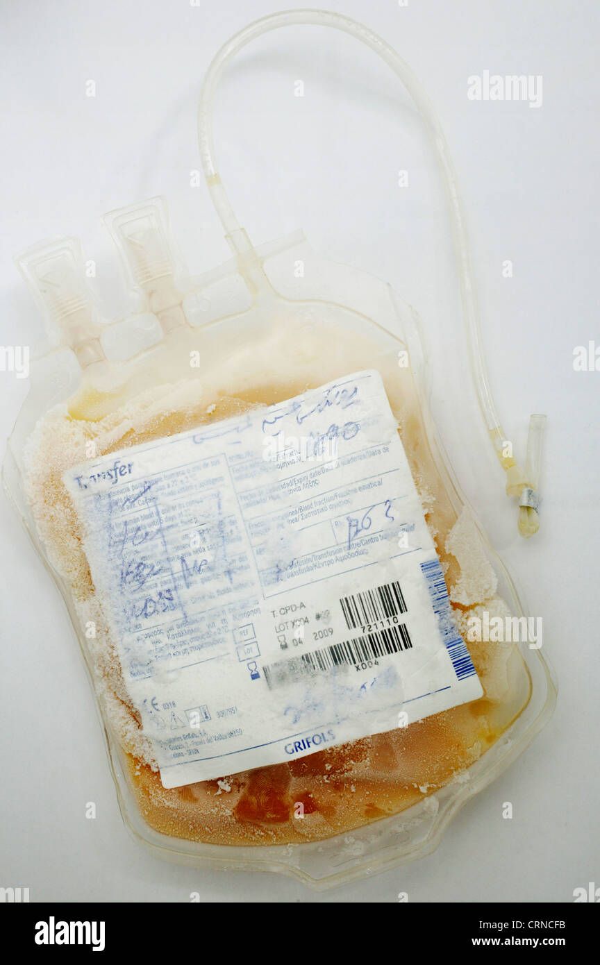 Congelati sacca di sangue Foto Stock