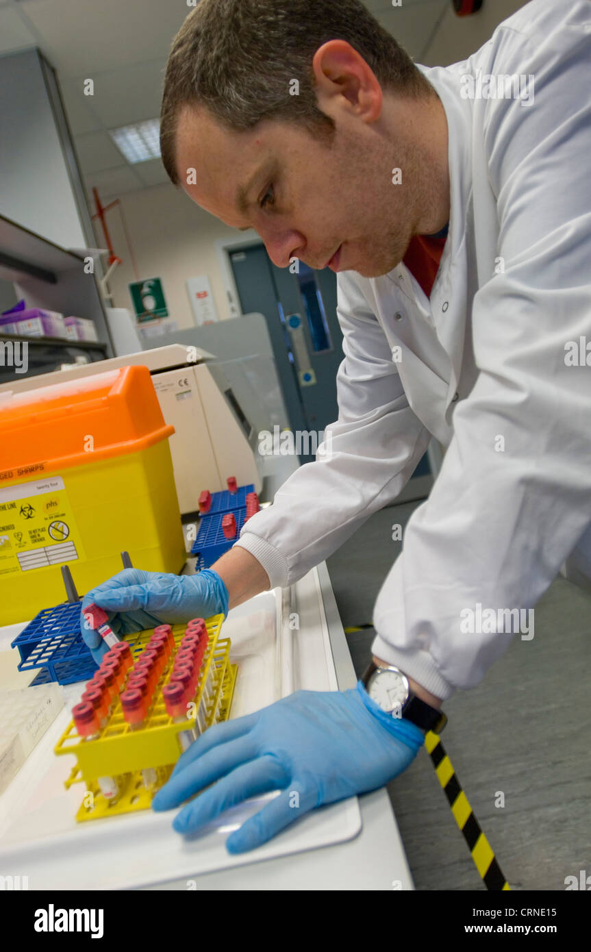 Uno scienziato controlla i campioni di saliva pronto per la ghiandola surrenale stress test del profilo Foto Stock