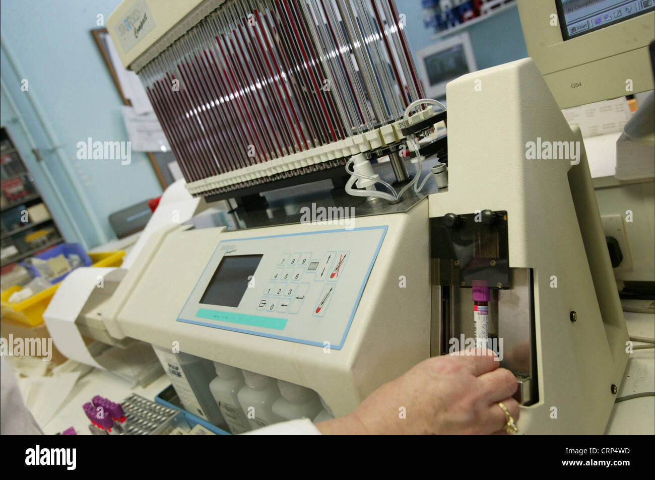 Un tecnico di laboratorio si prepara a campioni di sangue di prova. Foto Stock