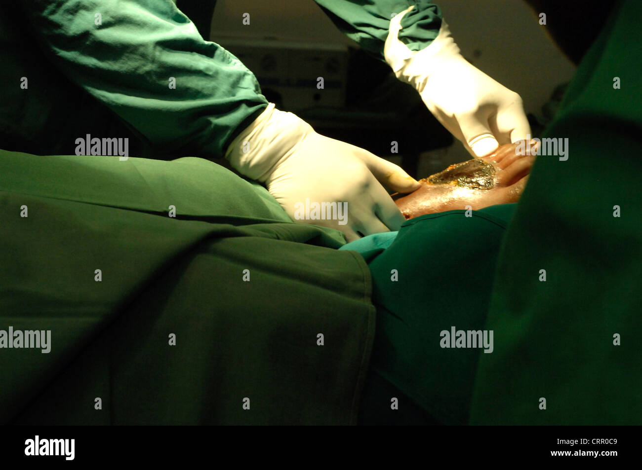 Chirurgo operante sul piede di un paziente Foto Stock