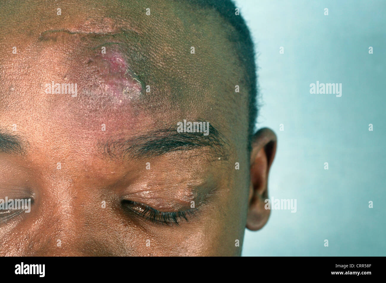 Arterie adolescente Foto Stock