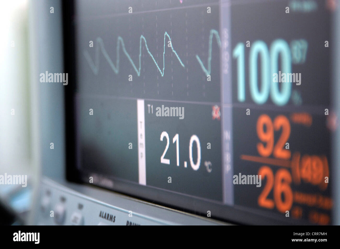 In prossimità del cuore del paziente sullo schermo del monitor. Foto Stock