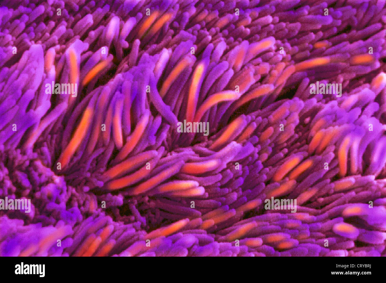 La mucosa nasale, SEM Foto Stock