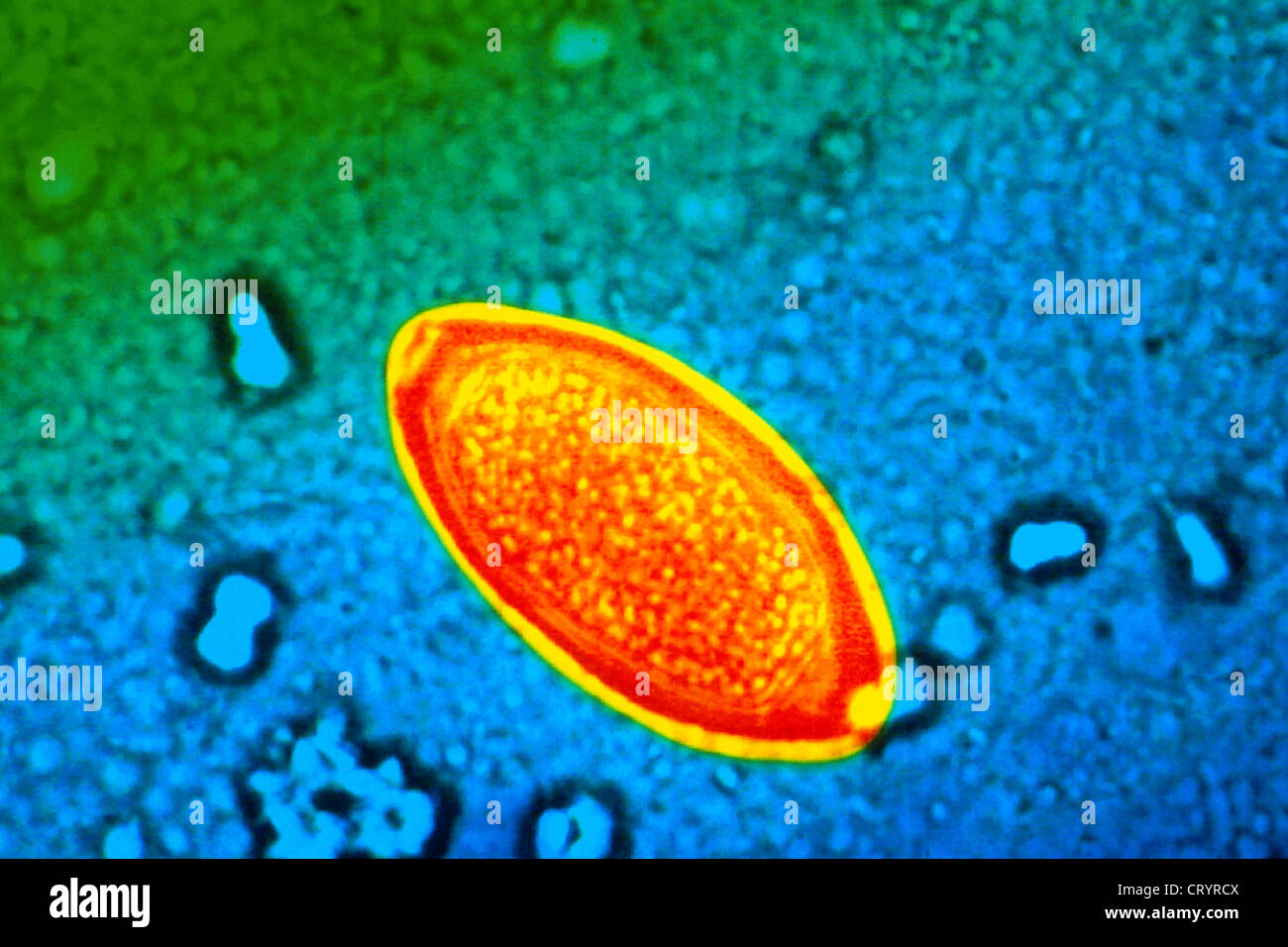 TRICHOCEPHALUS Foto Stock