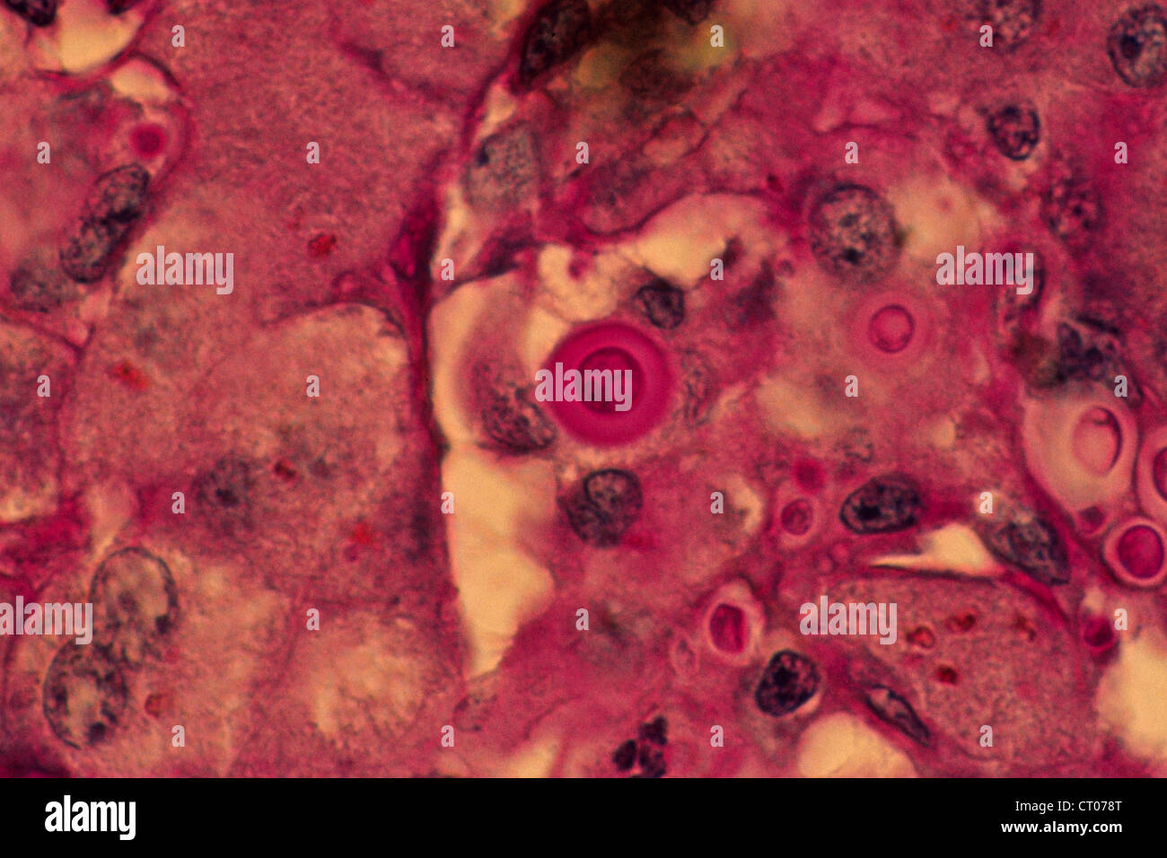 Cryptococcus neoformans immagini e fotografie stock ad alta risoluzione ...