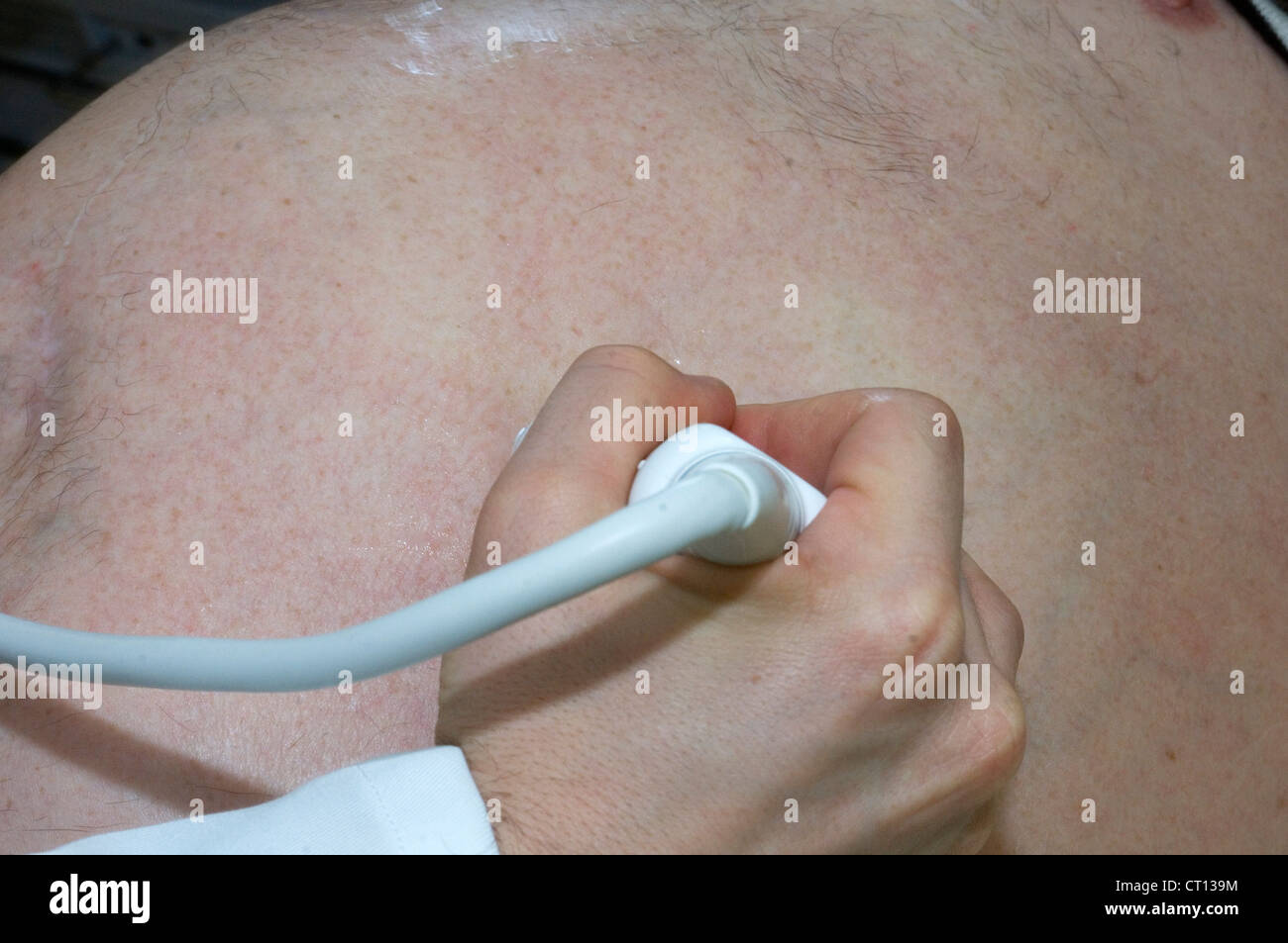 Un paziente di sesso maschile sottoposti a un esame ad ultrasuoni sul suo stomaco. Foto Stock