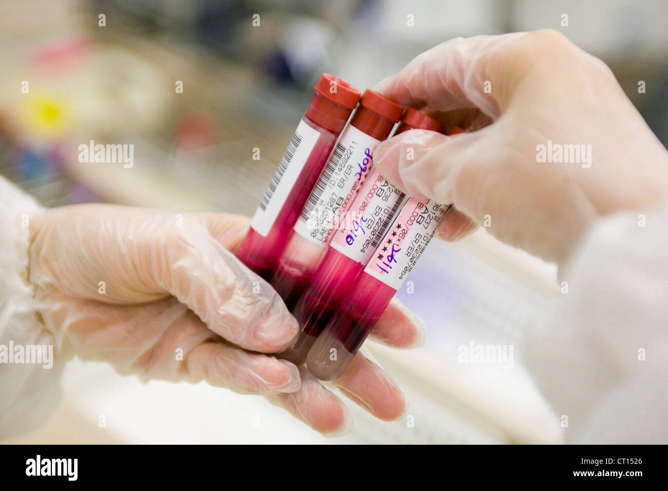 Un medico tenere i campioni di sangue Foto Stock