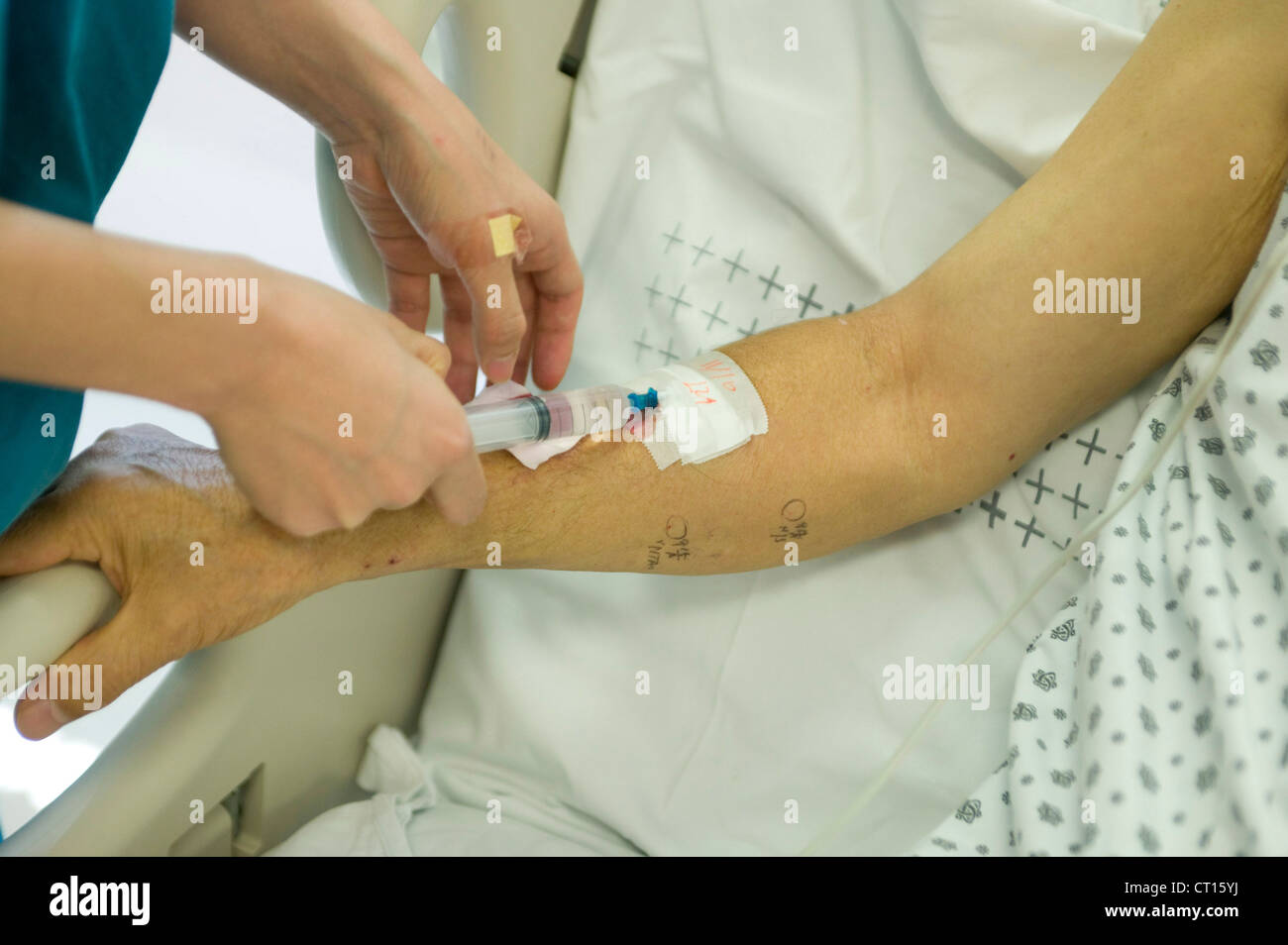 Un paziente ha un gocciolamento endovenoso inserito nel braccio su un'unità di terapia intensiva. Foto Stock