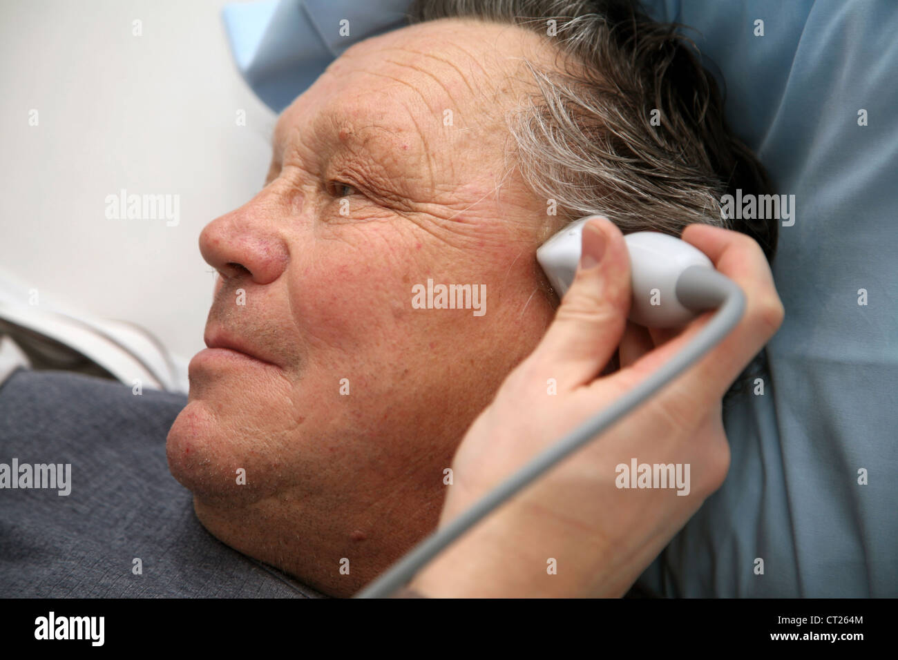 TRANSCRANIAL sonografia doppler Foto Stock