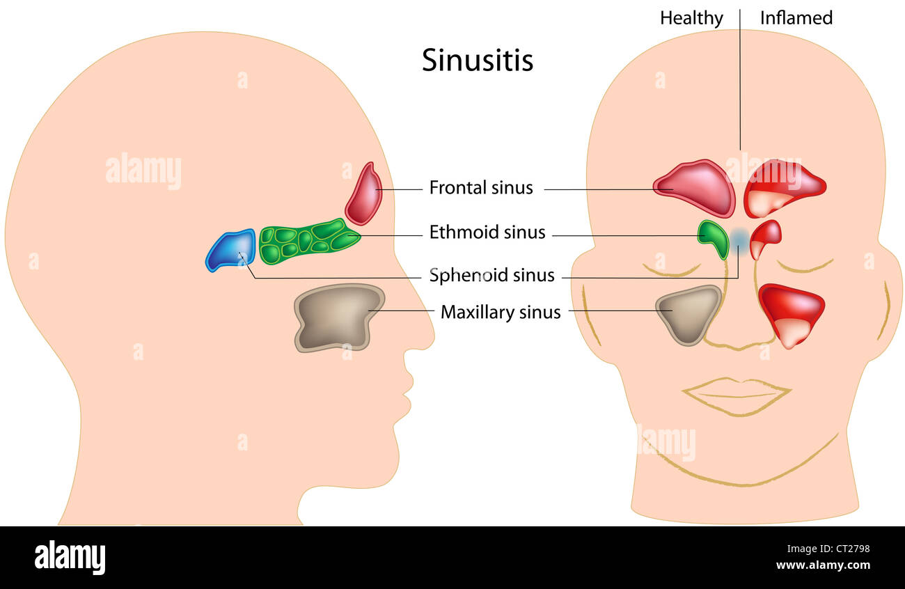 Seni di testa umana e sinusite Foto Stock