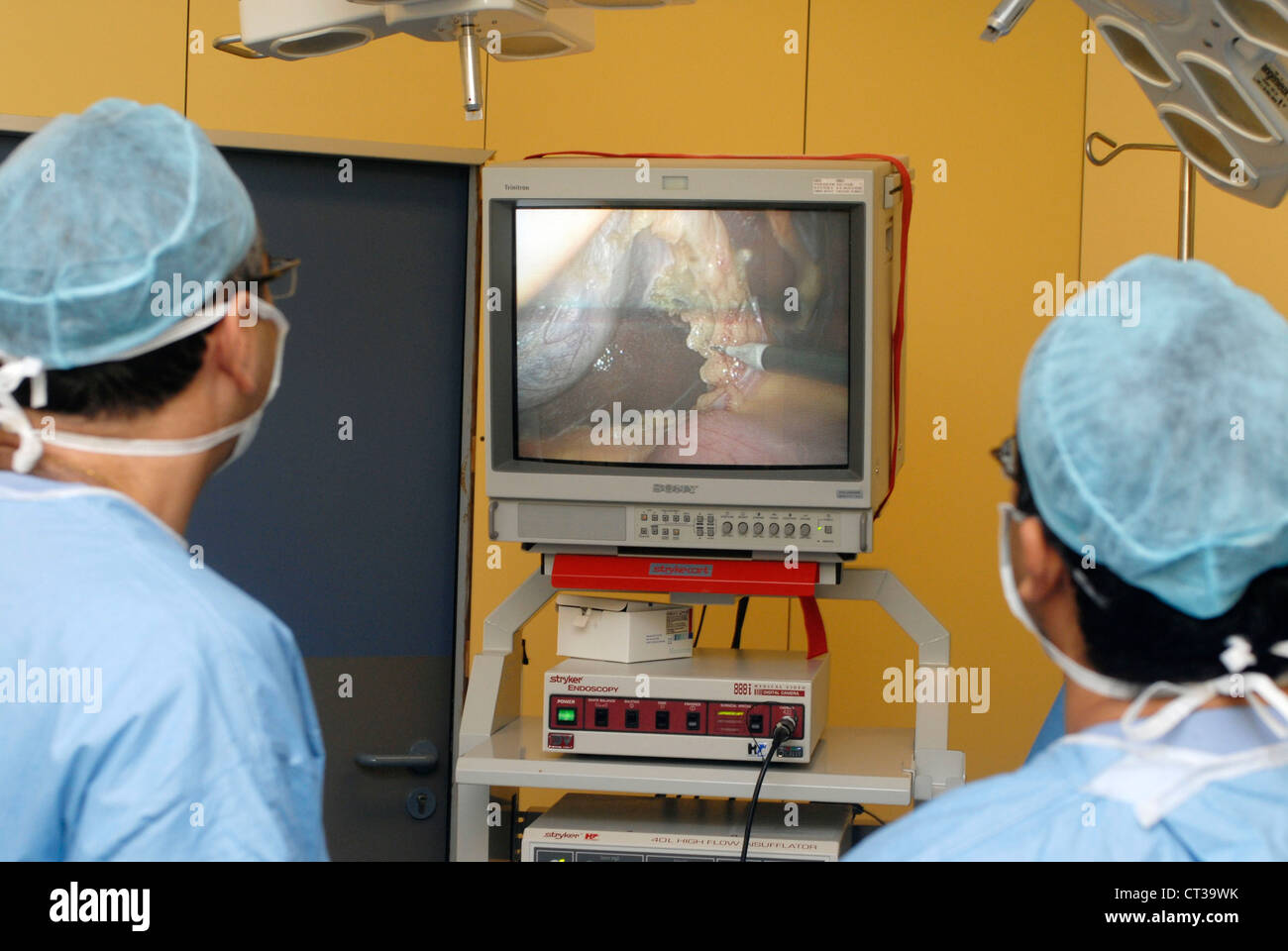 La rimozione della cistifellea Foto Stock