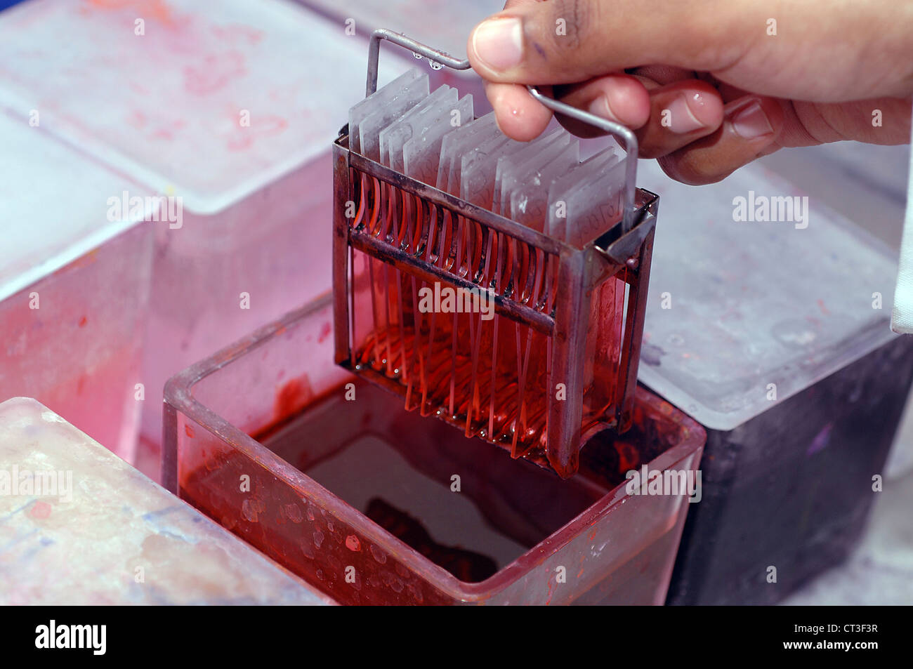 Un array di vetrini per microscopio in procinto di essere esaminato per individuare eventuali segni di patologia. Foto Stock