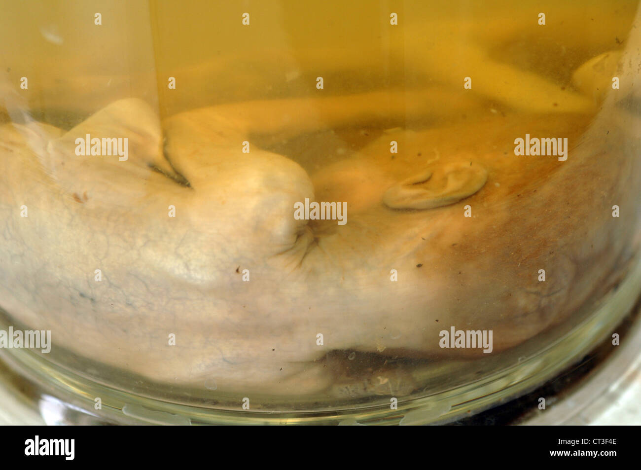 Il corpo di un feto conservati in formaldeide. Foto Stock