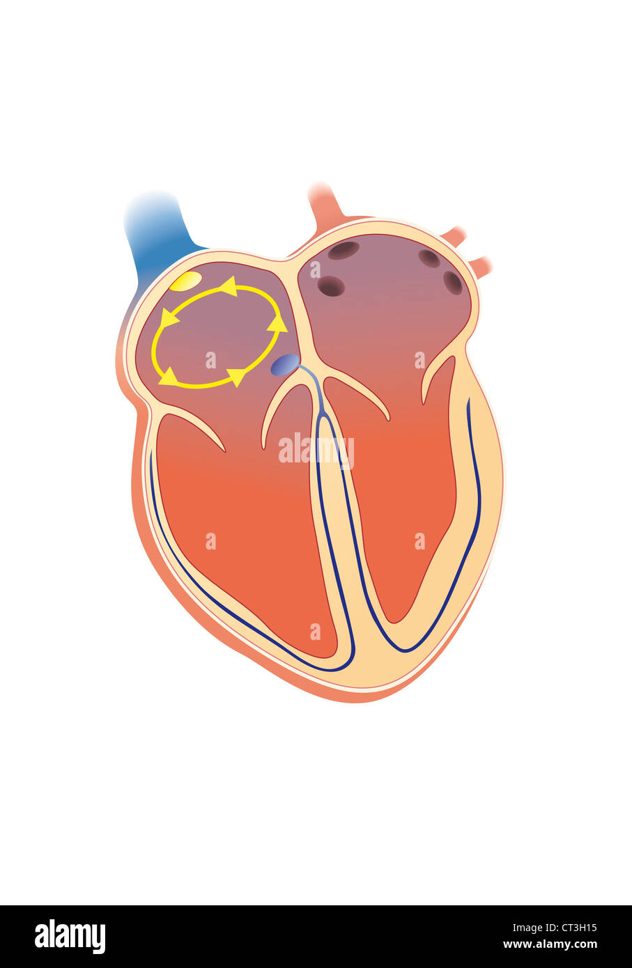 Sfarfallamento cardiaco, illustrazione Foto Stock