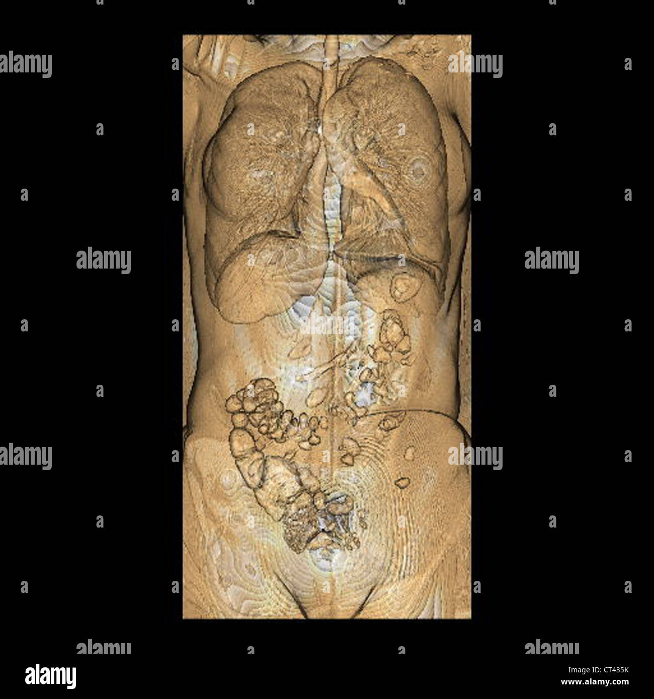 TRONCO, 3D SCAN Foto Stock