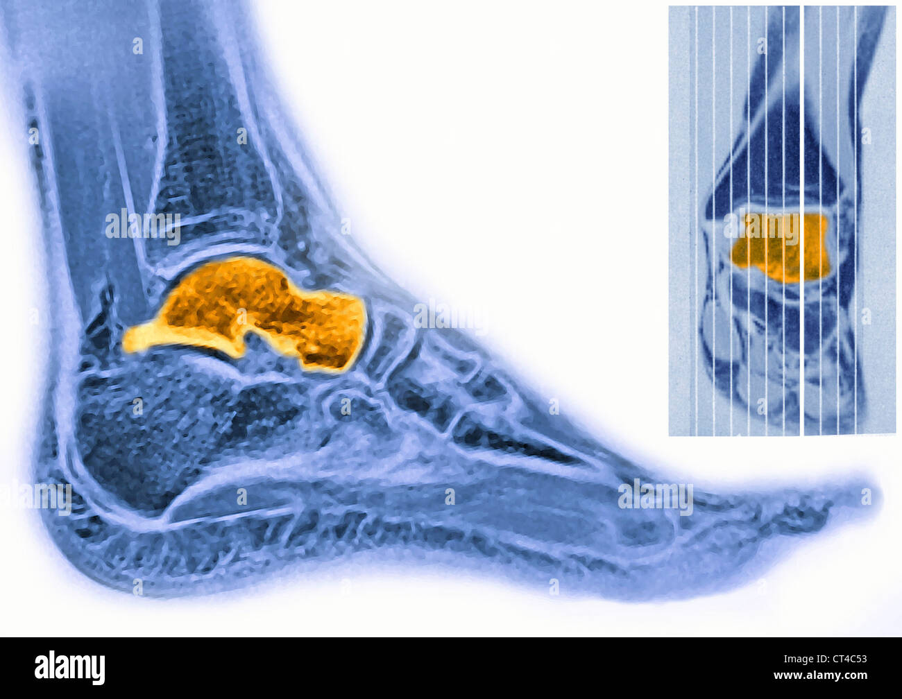 risonanza-magnetica-imaging-mri-immagini-e-fotografie-stock-ad-alta