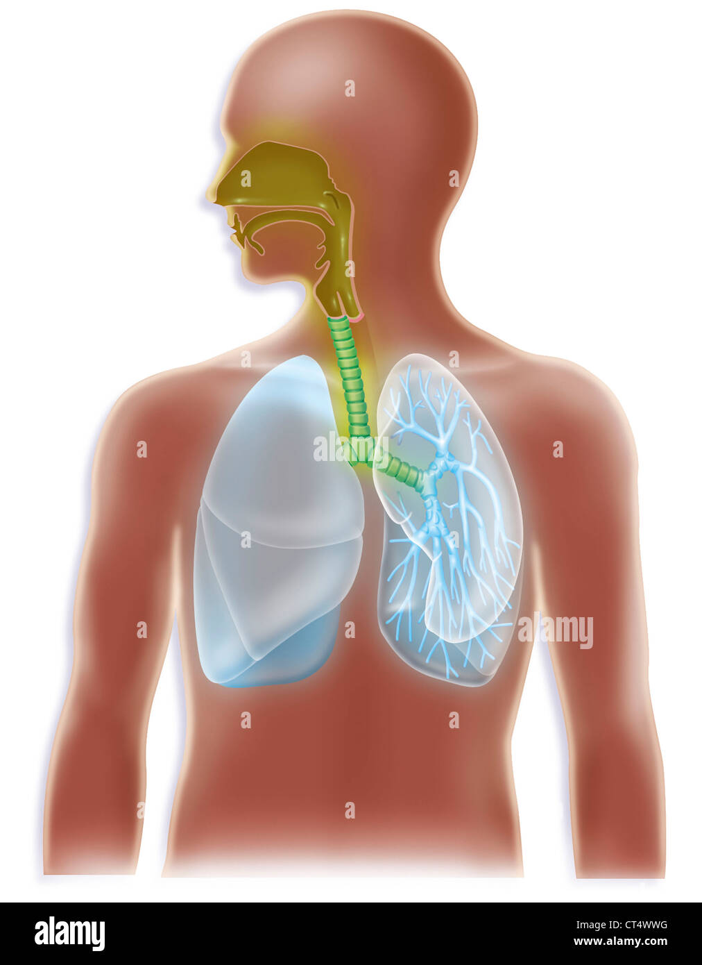 Influenza aviaria, disegno Foto Stock