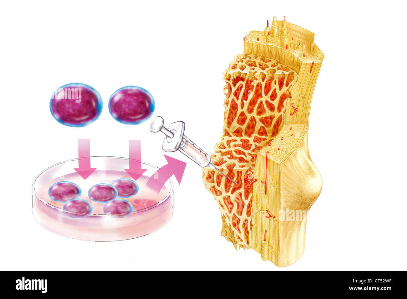 Terapia cellulare, illustrazione Foto Stock