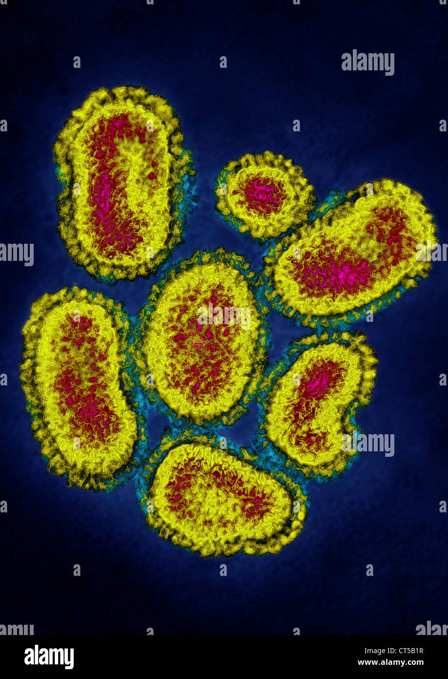 INFLUENZA A VIRUS H1N1 Foto Stock