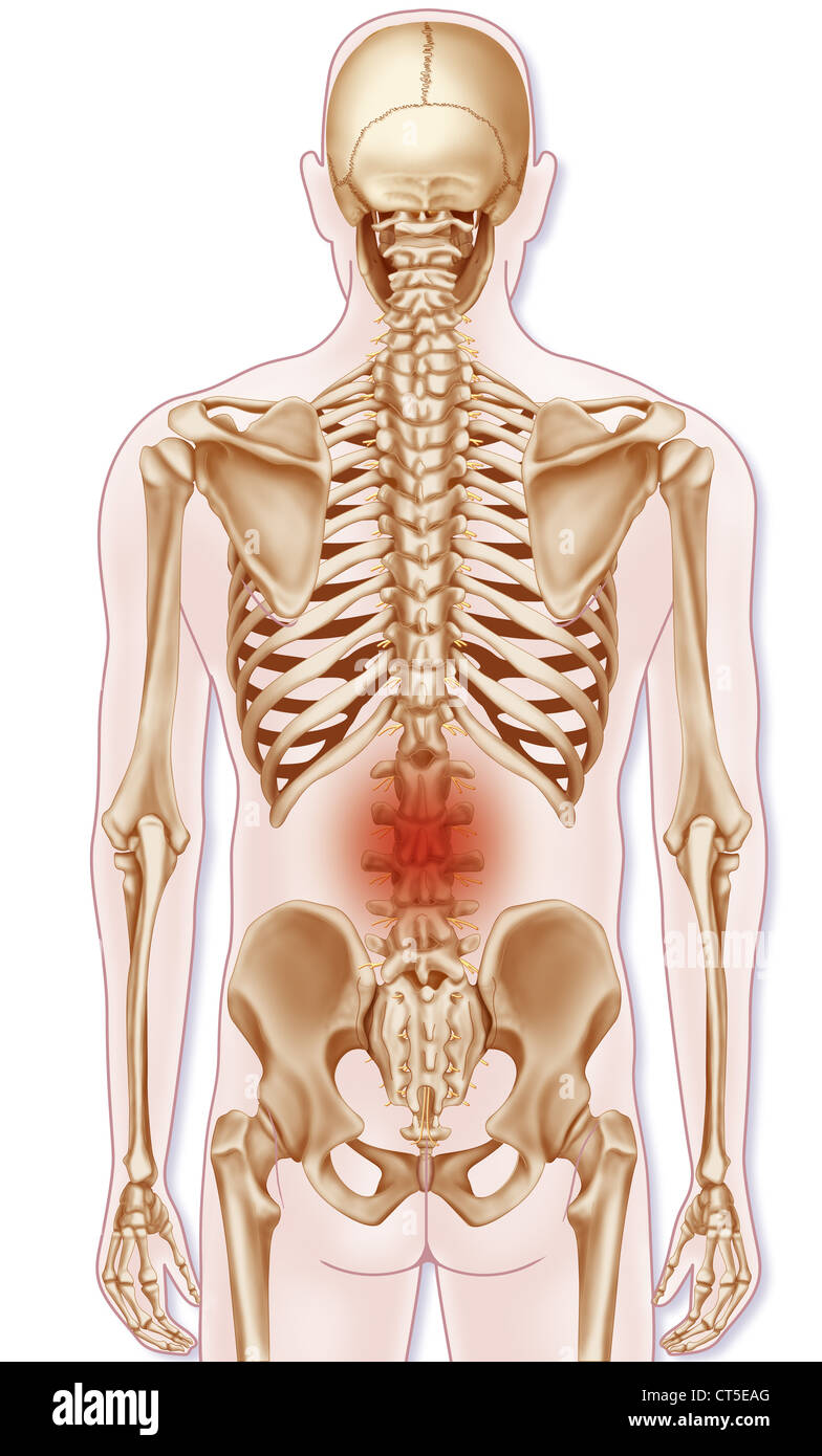 I dolori alla parte inferiore della schiena, illustrazione Foto Stock