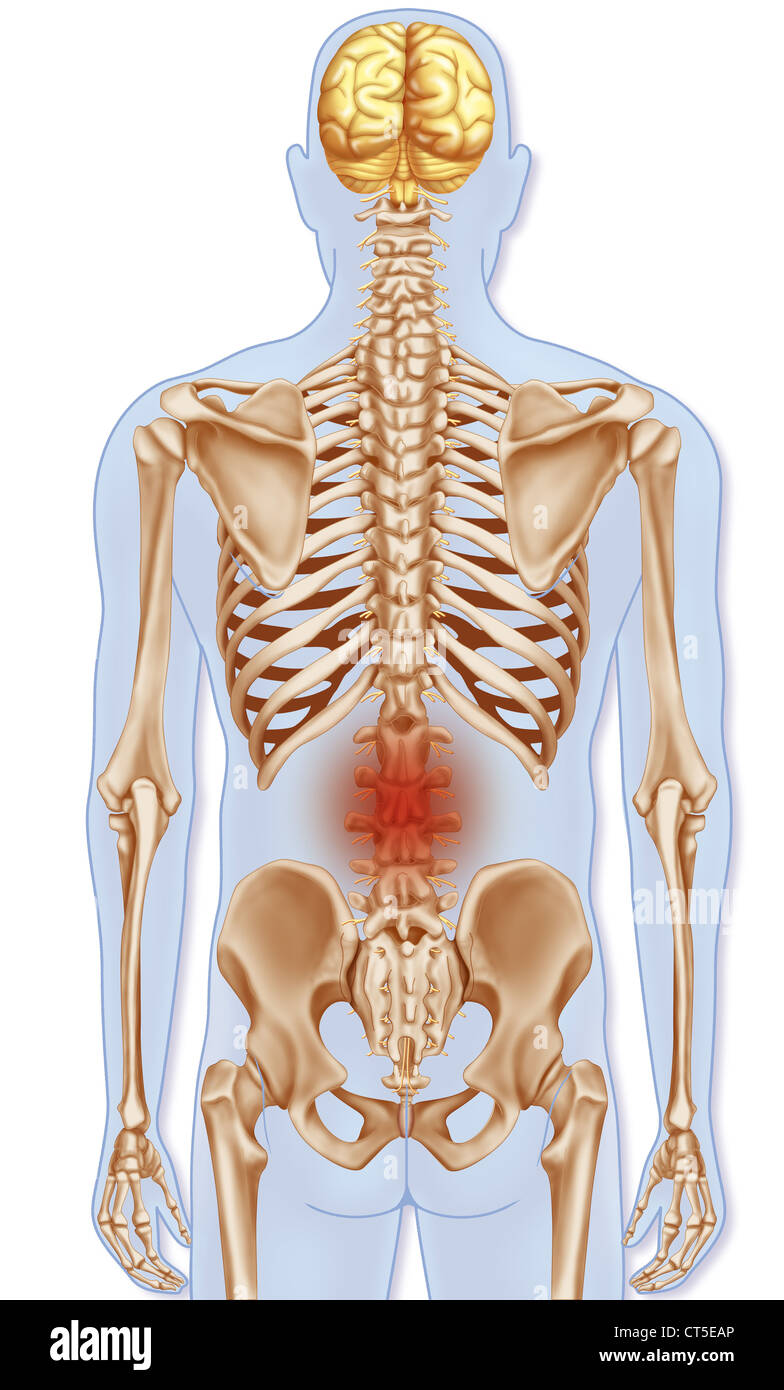 I dolori alla parte inferiore della schiena, illustrazione Foto Stock