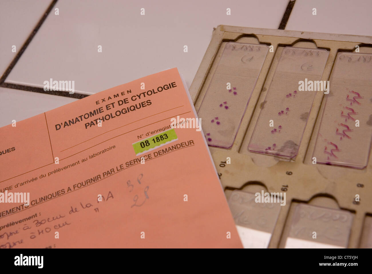 Patologia anatomica Foto Stock
