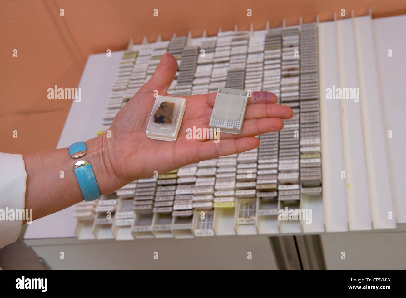 Patologia anatomica Foto Stock