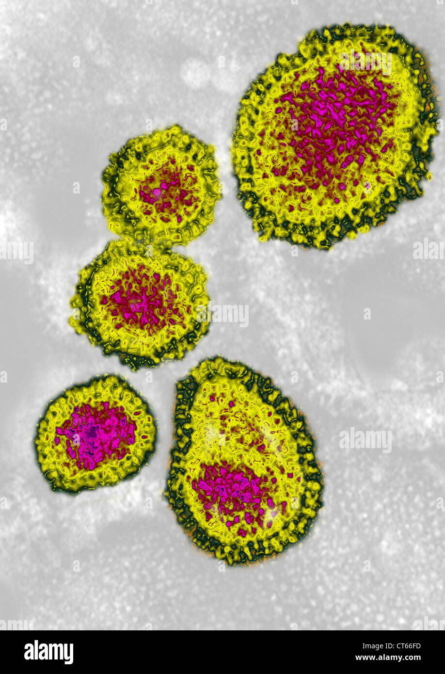 INFLUENZA A VIRUS H1N1 Foto Stock
