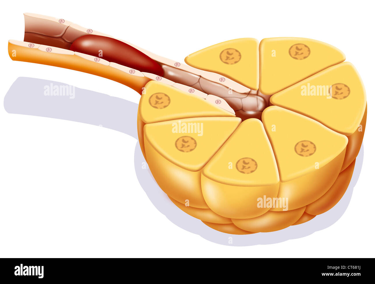 La pancreatite, disegno Foto Stock
