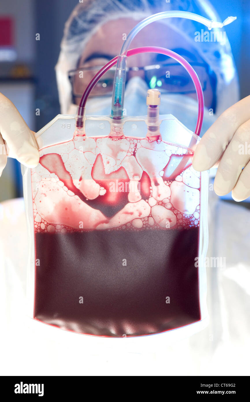 SANGUE DEL CORDONE OMBELICALE Foto Stock