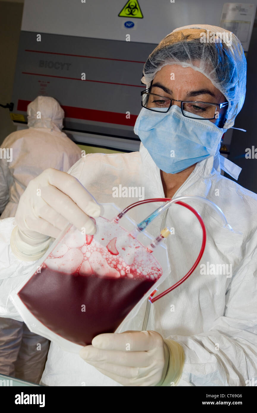SANGUE DEL CORDONE OMBELICALE Foto Stock