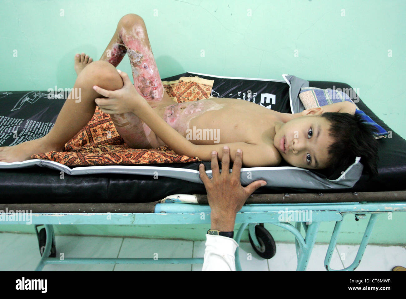 Tsunami-traumatizzati boy Foto Stock