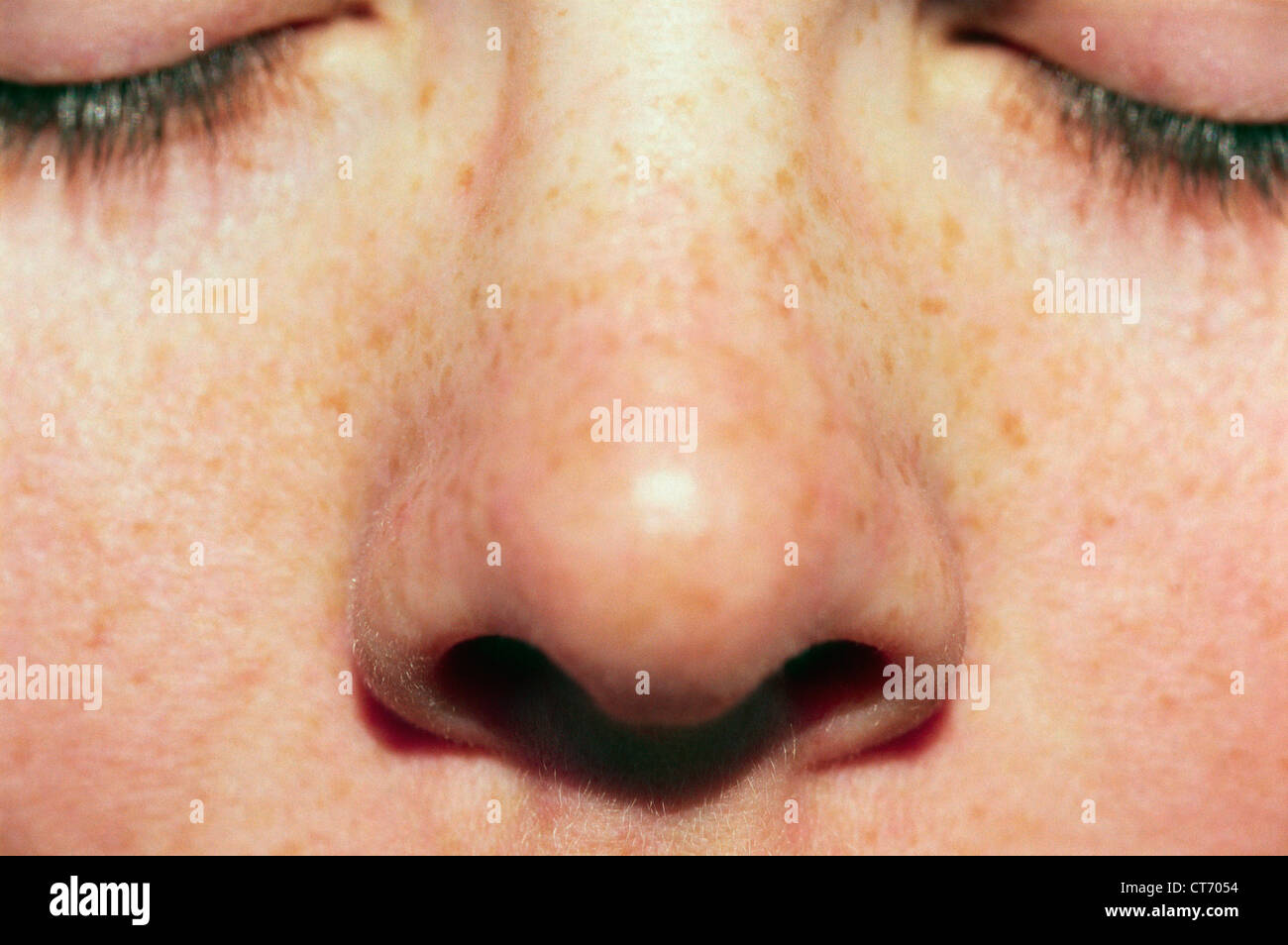 Un close up di un volto con le lentiggini e gli occhi chiusi. Foto Stock