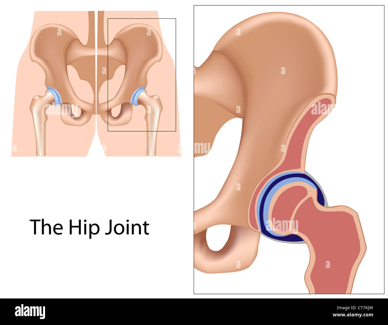 Hip struttura di giunto Foto Stock