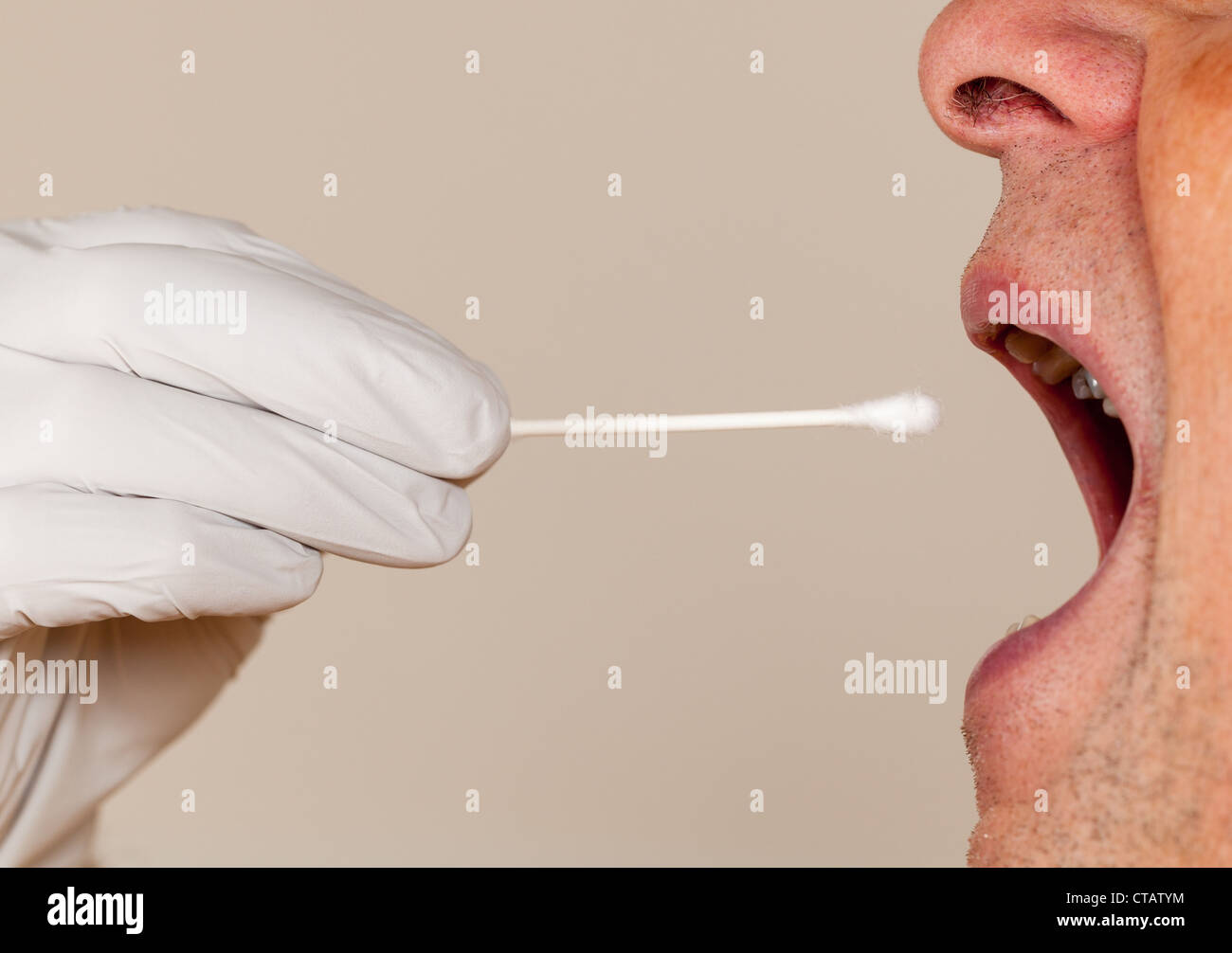 La mano guantata prendendo un fluido corporeo campione per il test del DNA dal senior persona maschio Foto Stock