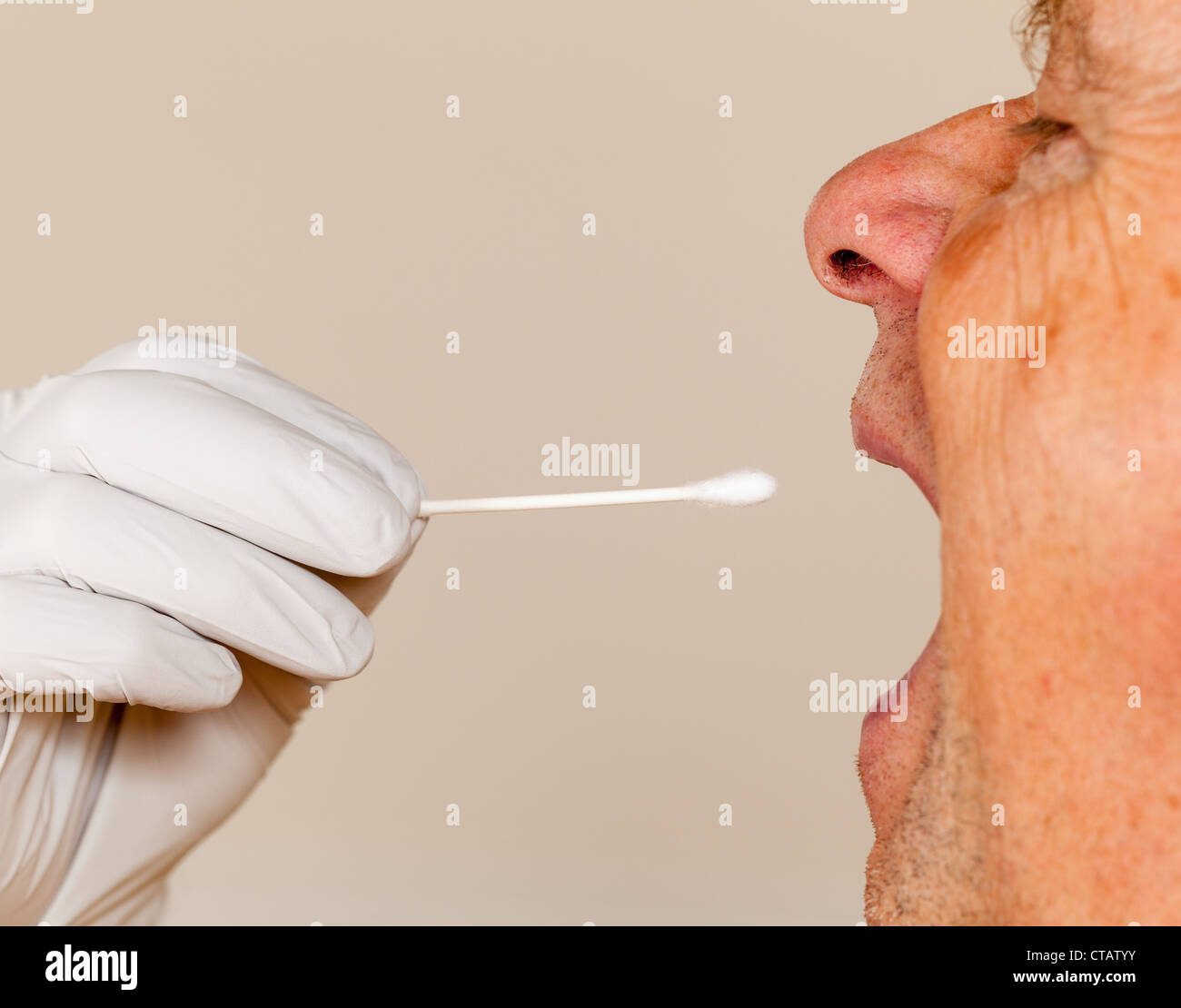 La mano guantata prendendo un fluido corporeo campione per il test del DNA dal senior persona maschio Foto Stock