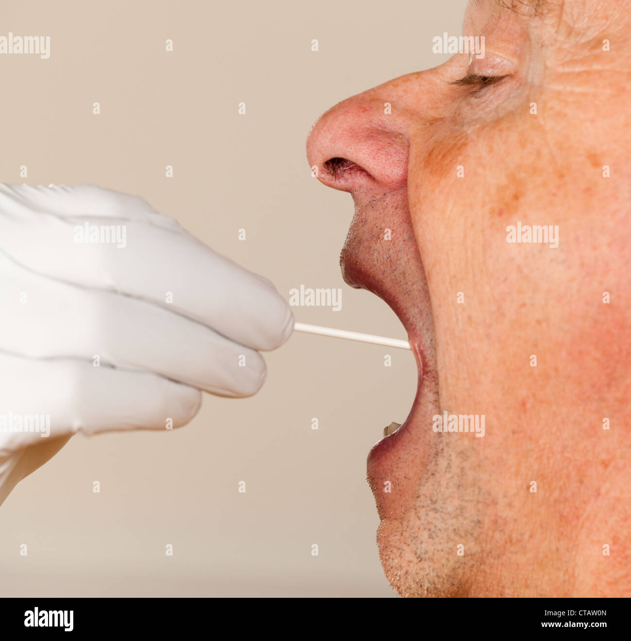 La mano guantata prendendo un fluido corporeo campione per il test del DNA dal senior persona maschio Foto Stock