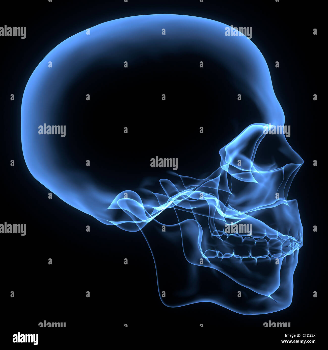 Cranio umano X-ray artwork Foto Stock
