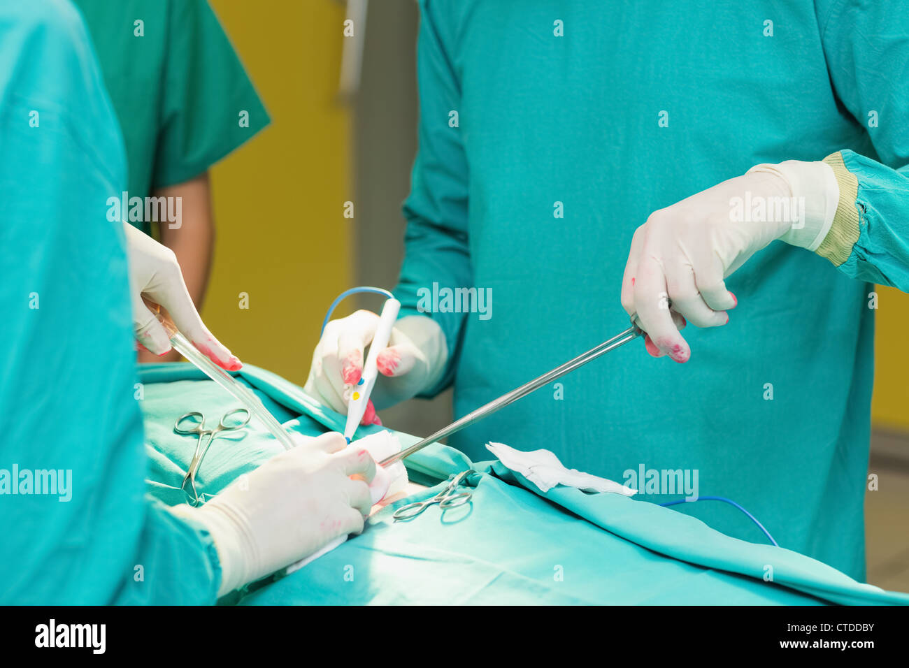 Close up di un chirurgo utilizzando un forbici chirurgiche Foto Stock