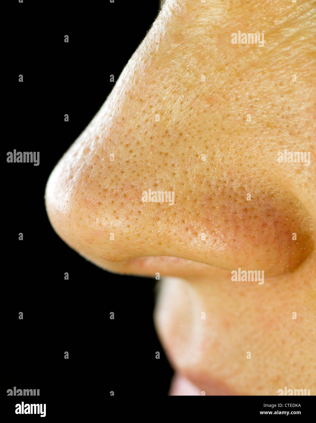 Punti neri sul naso. Macro Foto stock - Alamy