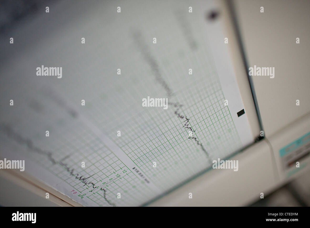 Baby Grafico frequenza cardiaca Foto Stock