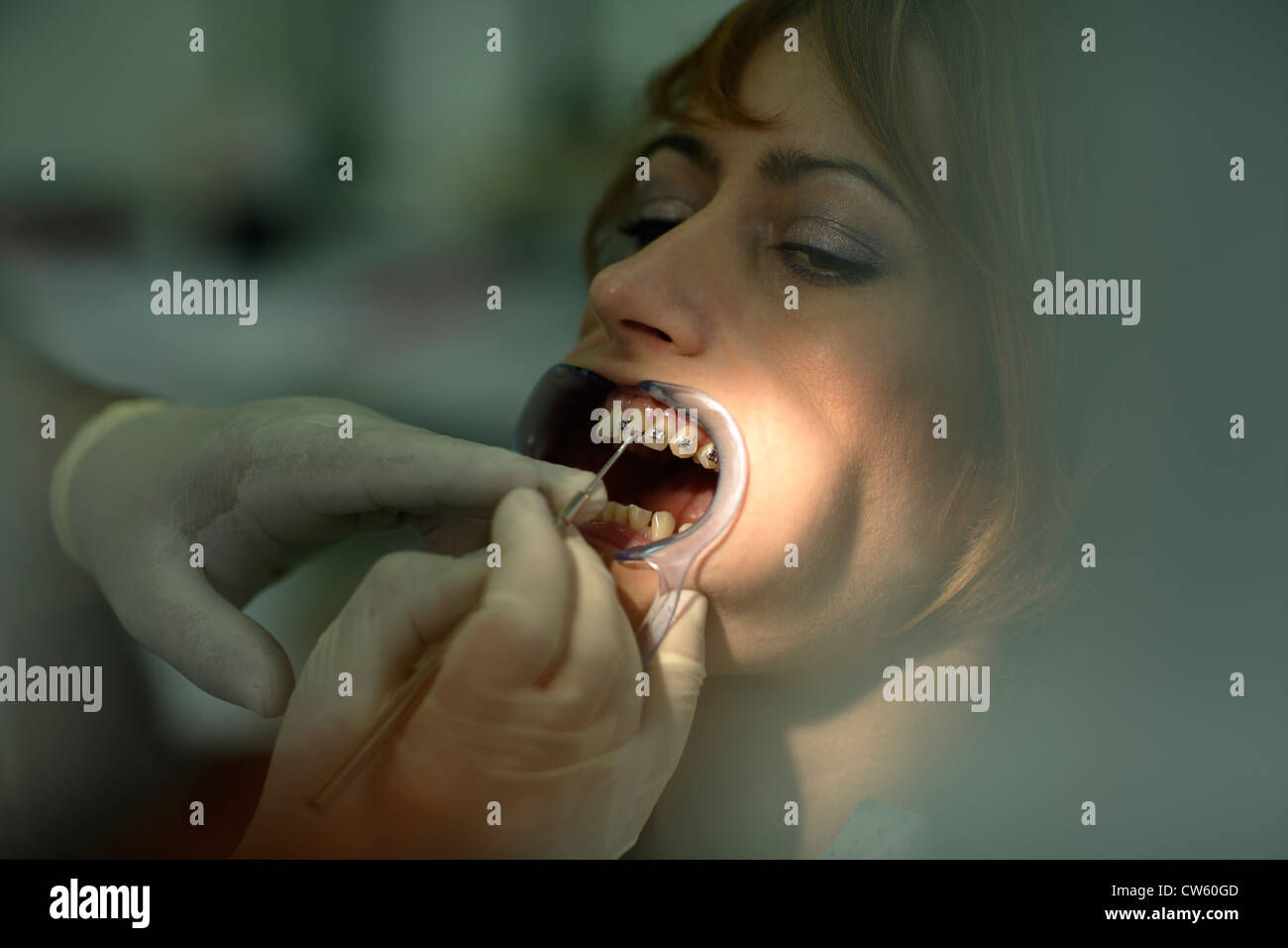 Dentista fornisce bretelle dentale paziente Foto Stock