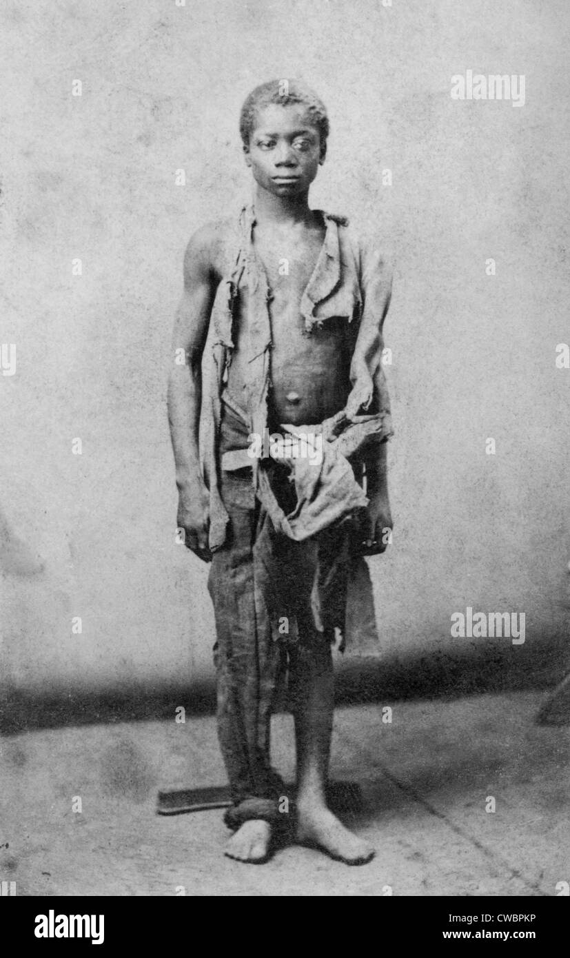 Giovani slave durante la guerra civile ridotto a tale povertà indossa solo stracci. Ca. 1863. Foto Stock
