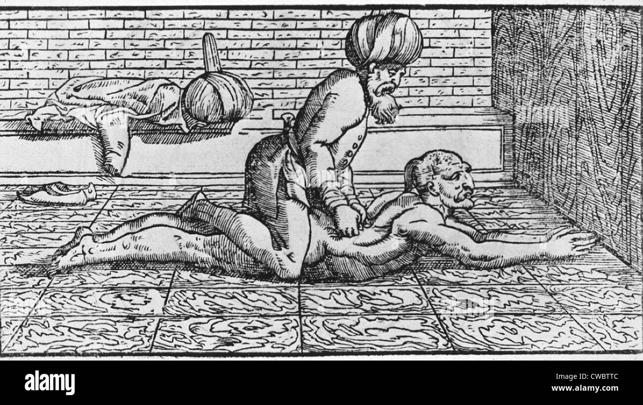 Medico Un massaggio schiena del paziente. Illustrazione di un libro europeo, basato su scritti del medico arabo Avicenna (980?-1037). Foto Stock