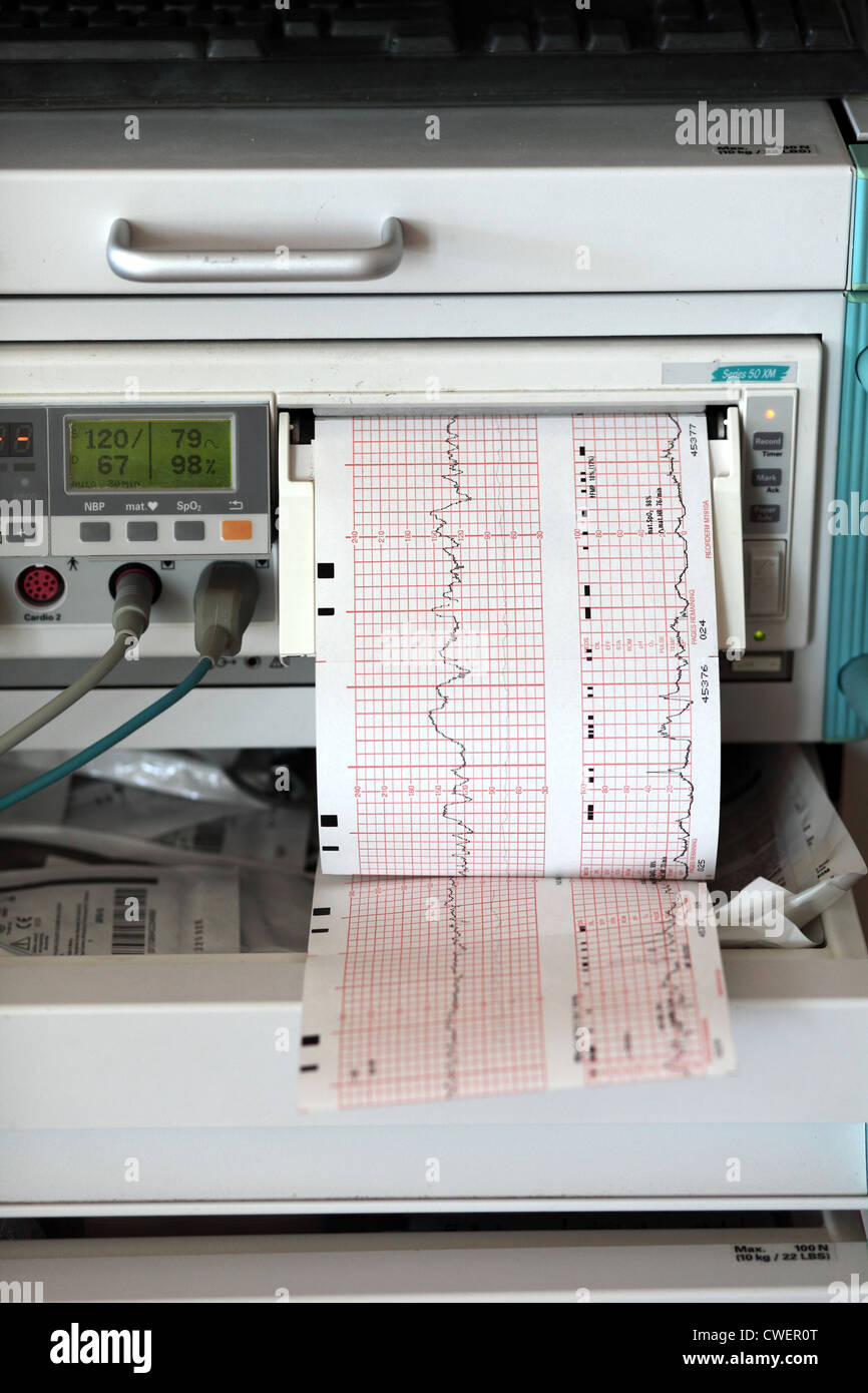 Monitor di contrazione in ospedale reparto di maternità Foto Stock