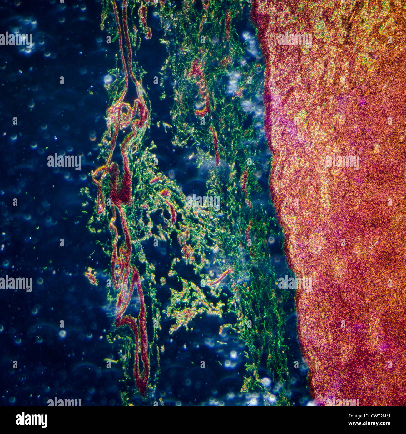 La scienza medica fisiologia anthropotomy sezione microscopica del nodo linfatico sullo sfondo del tessuto Foto Stock